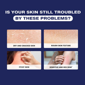 40% <span class=keywords><strong>Urea</strong></span> Foot Cream Anti Crack Hidratante Cutin Foot Cream Anti Crack Exfoliante Intensivamente Nutritiva <span class=keywords><strong>Crema</strong></span> para manos y pies - Product Image 4