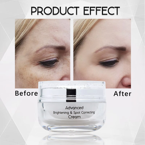 Crema Facial Blanqueadora MABLY, Reduce la Pigmentación, Hidrata Sin Sensación Grasa, Crema Aclarante y Anti-Manchas Premium - Product Image 4