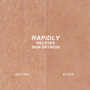 Loción Desodorante Corporal Flora Ruby, Paquete <span class=keywords><strong>de</strong></span> 5, Caja Elegante, Neutralizante <span class=keywords><strong>de</strong></span> Olores, Hidratante Ligero para Axilas y Pies - Product Image 2