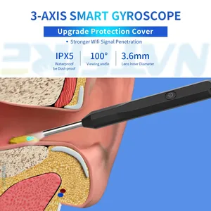 Otoscopio WiFi Portátil con Cámara, Removedor <span class=keywords><strong>de</strong></span> Cera <span class=keywords><strong>de</strong></span> <span class=keywords><strong>Oídos</strong></span>, <span class=keywords><strong>Limpiador</strong></span> <span class=keywords><strong>de</strong></span> <span class=keywords><strong>Oídos</strong></span> <span class=keywords><strong>Eléctrico</strong></span> Inteligente con Batería <span class=keywords><strong>de</strong></span> 130 mAh y 35 Minutos <span class=keywords><strong>de</strong></span> Autonomía - Product Image 2