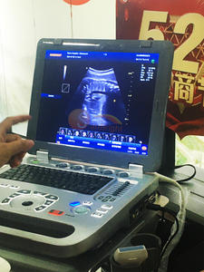 Professionele Cardiale Kleur <span class=keywords><strong>Doppler</strong></span> Echografie 15 Inch Pc-Gebaseerde Dieren Kleur <span class=keywords><strong>Doppler</strong></span> - Product Image 2