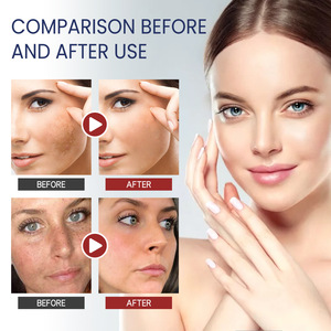 Venta caliente crema blanqueadora de la piel orgánica <span class=keywords><strong>477</strong></span> crema facial antienvejecimiento que reduce la hinchazón líneas finas - Product Image 3