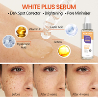 Marque privée Vitamine C Dissolvant de Taches Noires Produits de Soins de la Peau Blanchissant Éclaircissant Élimination des Taches Noires Sérum de Blanchiment du Visage