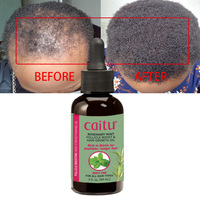 Romarin Menthe Follicule Boost Croissance Cheveux Naturels Huile Essentielle De Menthe Poivrée En Gros