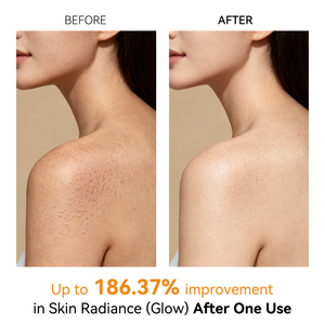 Spray Exfoliant Corps et Visage Exclusif Transfrontalier à l'Acide Kojique et au Curcuma, Hydratant et Lissant pour Femmes, Tous Types de Peau - Product Image 2