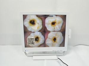 Équipement dentaire intelligent tout-en-un de haute qualité avec visualiseur <span class=keywords><strong>oral</strong></span> électrique, 2MP, mise au point 10-40mm, HDMI, application et support avec poignée - Product Image 5