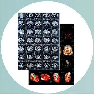 فيلم أشعة سينية طبي أبيض 125/150/180 ميكرون للتصوير الإشعاعي بتقنية الليزر والطباعة النافثة للحبر لأنظمة التصوير الرقمي والتصوير بالرنين المغناطيسي - Product Image 5