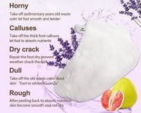 Masques Exfoliants Personnalisés ZS pour les Pieds, Chaussettes de Pédicure Gommantes pour Éliminer les Peaux Mortes, Masque Peeling pour Talons et Pieds