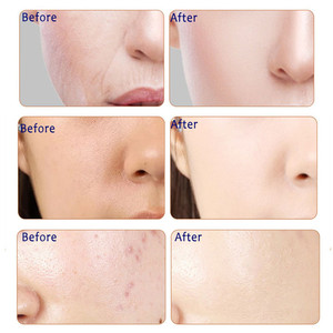 <span class=keywords><strong>Mascarilla</strong></span> Facial <span class=keywords><strong>hidratante</strong></span> con esencia de caracol, cuidado de <span class=keywords><strong>la</strong></span> piel, blanqueador, Control de Aceite <span class=keywords><strong>hidratante</strong></span>, removedor de espinillas, 2019 - Product Image 4