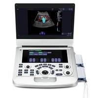 Ecógrafo Doppler Portátil Tipo Laptop con Imágenes a Color, Mediciones Automáticas, 256 Fotogramas y Función Cine Loop para Diagnóstico General