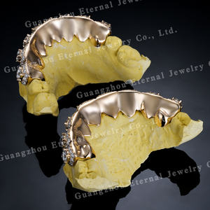 Rejilla Dental Personalizada de Plata S925 con Baño de Oro Rosa, con Incrustaciones de Moissanita VVS y Diamantes de Laboratorio con Corte Permanente, para Dientes - Product Image 3