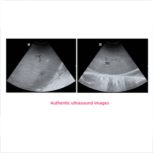 Manichino per Addestramento ad Ultrasuoni per Puntura Epatica con Fegato, Vescica Biliare e Vena Cava Inferiore per l'Apprendimento delle Abilità Interventistiche - Product Image 2