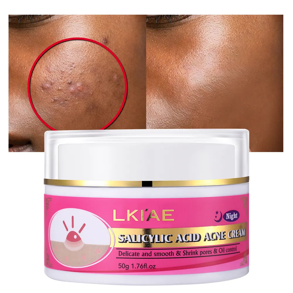 Bán buôn loại bỏ mụn trứng cá Kem salicylic axit giữ ẩm nhãn hiệu riêng chống mụn sẹo đánh dấu loại bỏ khuôn mặt mụn trứng cá Kem đêm