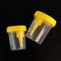 Laboratorio de alta calidad, plástico desechable, estéril, muestra de vacío, colección de muestras, contenedor de orina