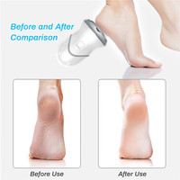 Broyeur de pieds électrique automatique sans fil, élimine les callosités de la peau morte, accessoire de pédicure, Rechargeable par usb