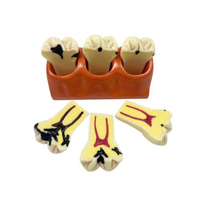 Modèles de comparaison des caries (4 fois grandis), Modèle de dents décomposées pour l'enseignement, la <span class=keywords><strong>recherche</strong></span> et l'étude en dentisterie pour étudiants - Product Image 3