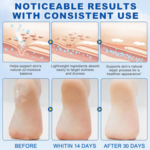 Crème pour les pieds à 60% d'urée avec 2% d'acide salicylique, baume pour éliminer les callosités, pour les talons, les mains et les genoux secs et gercés - Product Image 3