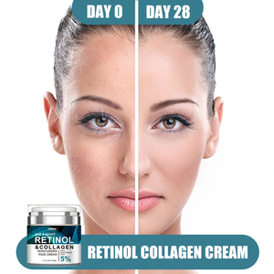 Naturals Retinol Anti Aging Cream Combats Wrinkles Fine Lines Uneven Skin Tone Rough <strong>Texture</strong> - Product Image 5