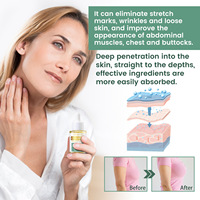 Huile corporelle raffermissante au collagène huile corporelle liftante Anti Cellulite ventre cuisse combustion des graisses soin des rides huile amincissante
