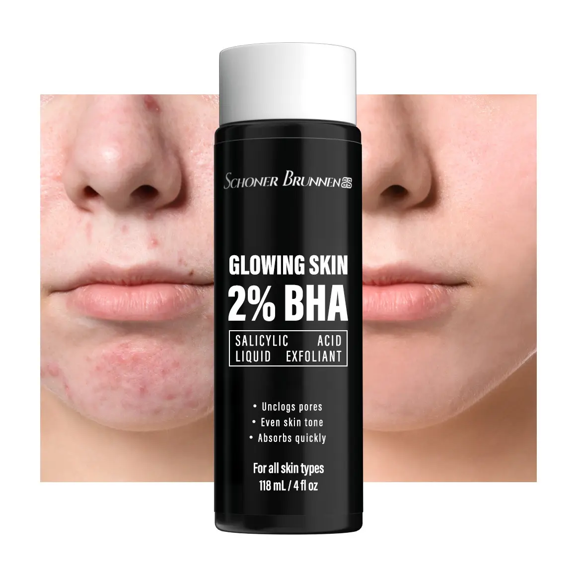 Wholesale Choice 2% BHA Skin Perfecting Salicylic Acid Liquid Exfoliant Serum