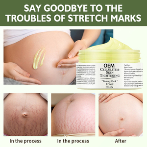 OEM Shea Butter Stretch Mark <strong>Cream</strong> Obesity Body Line Care <strong>Cream</strong> Firming Nourishing <strong>Fading</strong> Postpartum Stretch Mark Repair <strong>Cream</strong> - Product Image 3