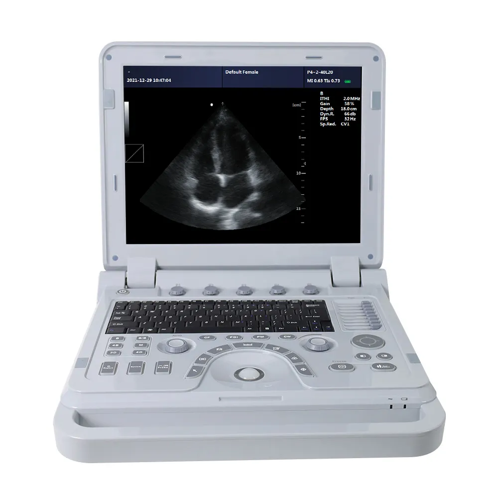 CONTEC CMS1700B doppler portable 3D 4D Echocardiography ultrasound machine
