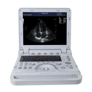 Contec cms1700b doppler portátil <span class=keywords><strong>3d</strong></span> <span class=keywords><strong>4d</strong></span> echocardiografia ultrassom máquina - Product Image 3