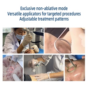 240W 피크 파워 주름 제거 모공 분수 CO2 레이저 요법 스트레치 마크 감소 C02 분수 레이저 기계 얼굴 치료 - Product Image 6