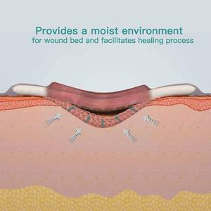 Perban Luka Perekat Tahan Air 10cmx10m Produksi Pabrik, Kalsium Alginat Medis IV Perak, Alat Kesehatan Sekali Pakai untuk Luka - Product Image 5