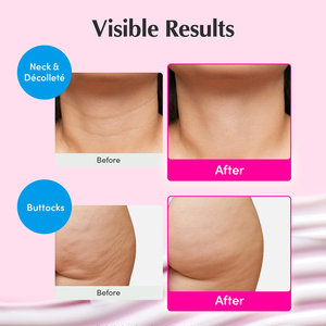 <span class=keywords><strong>Crema</strong></span> Viso e <span class=keywords><strong>Collo</strong></span> Rassodante e Lifting Effetto Lifting con Peptidi NAD+ Private Label <span class=keywords><strong>per</strong></span> Pelle Rilassata - Idratante Viso Skincare - Product Image 4