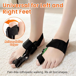 Corrector de <span class=keywords><strong>Juanetes</strong></span> Aiwecare, Soporte Ortopédico <span class=keywords><strong>para</strong></span> Hallux Valgus, <span class=keywords><strong>para</strong></span> Alineación del Dedo Gordo del Pie y Alivio del Dolor - Férula Flexible - Product Image 1