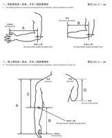 Prótesis de brazo, parte superior de las extremidades, mecánica, mano/brazo con cubierta de piel de silicona
