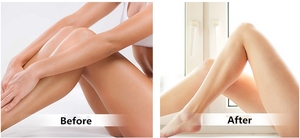 Crème éclaircissante et blanchissante pour la peau du vagin, pour le traitement des peaux noires - Product Image 5