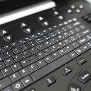 IN-P8Vet Portátil 4d <span class=keywords><strong>Cardiovascular</strong></span> Full Digital Color Doppler <span class=keywords><strong>Ultrasound</strong></span> Scanner Máquina Veterinária - Product Image 4