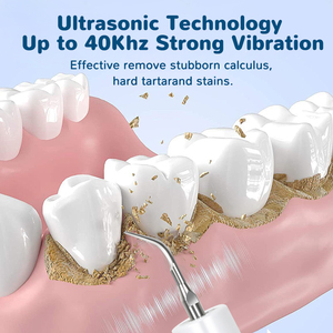 Hond Kat Grooming Smart Dentale Ultrasone <span class=keywords><strong>Scaler</strong></span> Huishoudelijke Tand Steen Pest Verwijderaar Tand Cleaner Mondreinigingstools - Product Image 5