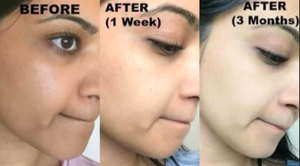 Private label minimum order quantity 1000 PCs very effective brightening skin eternal elinor bleaching cream - Product Image 5