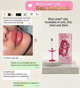 Gel injectable de rajeunissement cutané à base d'acide hyaluronique monophasique réticulé pour l'augmentation naturelle et brillante des lèvres - Product Image 5