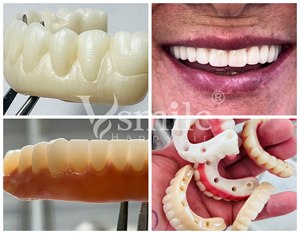 Disques de zirconium machine à cames dentaires 98mm <span class=keywords><strong>Vsmile</strong></span> 3D céramique de zircone multicouche utilisée en dentisterie - Product Image 6
