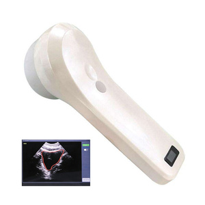 Escáner Inalámbrico de Vejiga 4D BProbe-2 para Diagnóstico por Ultrasonido en Cardiología, Gastroenterología, Urología y Riñón - Product Image 2