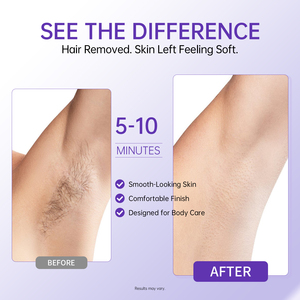 Crème <span class=keywords><strong>D</strong></span>épilatoire Douce Marque Blanche Faible Irritation Sans Sensation de Brûlure Épilateur Corporel Jambes Aisselles Peaux Sensibles - Product Image 5