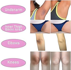 Krim pencerah kulit untuk ketiak gelap, lutut, siku, paha bagian dalam, garis Bikini, krim pemutih Area ketiak - Product Image 2