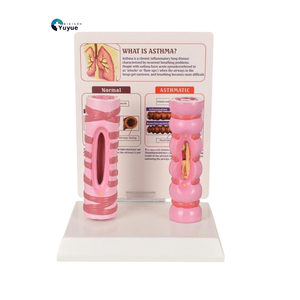 Medizinisches Lehrmodell: Vergleich von Normaler und Asthmatischer Luftröhre für Atemwegsunterricht - Product Image 1