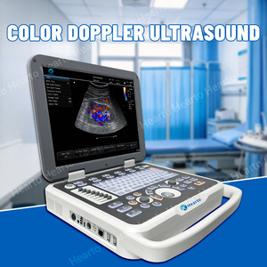 Escáner <span class=keywords><strong>de</strong></span> <span class=keywords><strong>Ultrasonido</strong></span> Doppler Color Portátil con Sonda Convexa Lineal para Obstetricia/Ginecología, <span class=keywords><strong>Abdomen</strong></span> y Vascular - Product Image 6