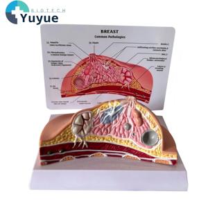Tıbbi Öğretim İçin Yaygın Patolojileri İçeren İnsan Meme Anatomisi Modeli - Product Image 1