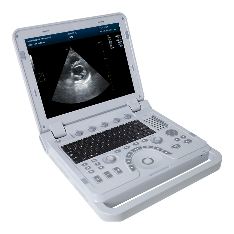 CONTEC CMS1700B Doppler แบบพกพา3D 4D เครื่องอัลตราซาวนด์ Echocardiography