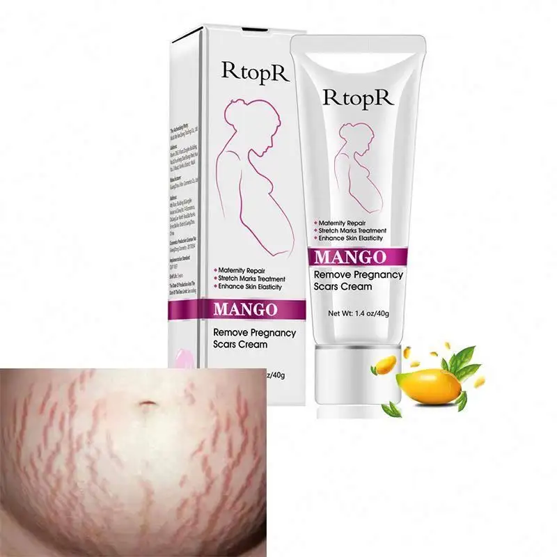 Face Care Acne Treatment Scar Stretch Marks Removal Skin Whitening Face Cream for Women