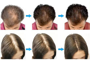 Nouveau type de masseur capillaire pour la croissance des cheveux, <span class=keywords><strong>brosse</strong></span> bio, pulvérisateur d'oxygène, appareil d'analyse du cuir chevelu, machine AC - Product Image 4