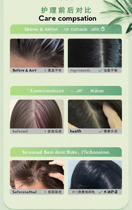 AP23 Fórmula Orgánica para el Crecimiento del Cabello y la Prevención de la Caída del Cabello, Equilibrio Agua-Aceite, Ingredientes Totalmente Naturales para Cabello Rizado Dañado - Product Image 6