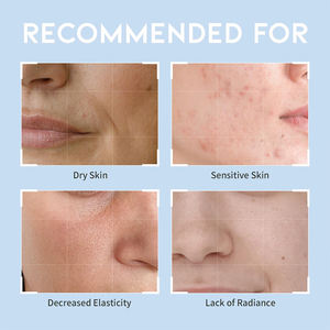 <span class=keywords><strong>Masque</strong></span> au collagène personnalisé <span class=keywords><strong>Masque</strong></span> facial hydratant en feuille Sérum au rétinol <span class=keywords><strong>Masque</strong></span> facial anti-âge pour soins de la peau - Product Image 6