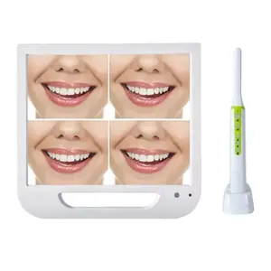 מפעל מכירה לוהטת באיכות hd אלחוטי דיגיטלי Usb INTRAORAL אנדוסקופ מפעל מכירה לוהטת